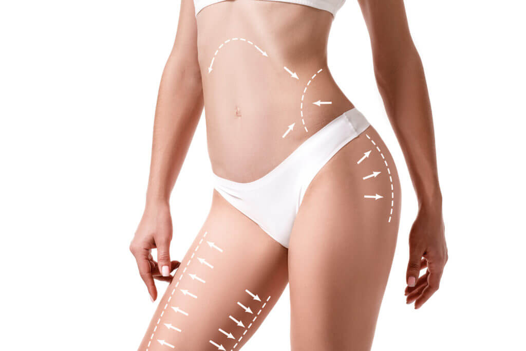 Key Differences Between Liposuction and Tummy Tuck